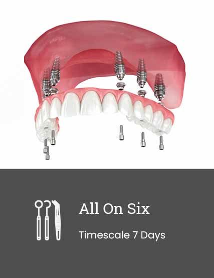All on 4 Dental Implants (Yakında Türkçe)