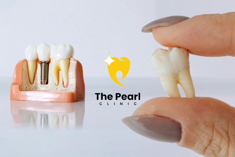 Modern Solution for Tooth Loss! (Yakında Türkçe)