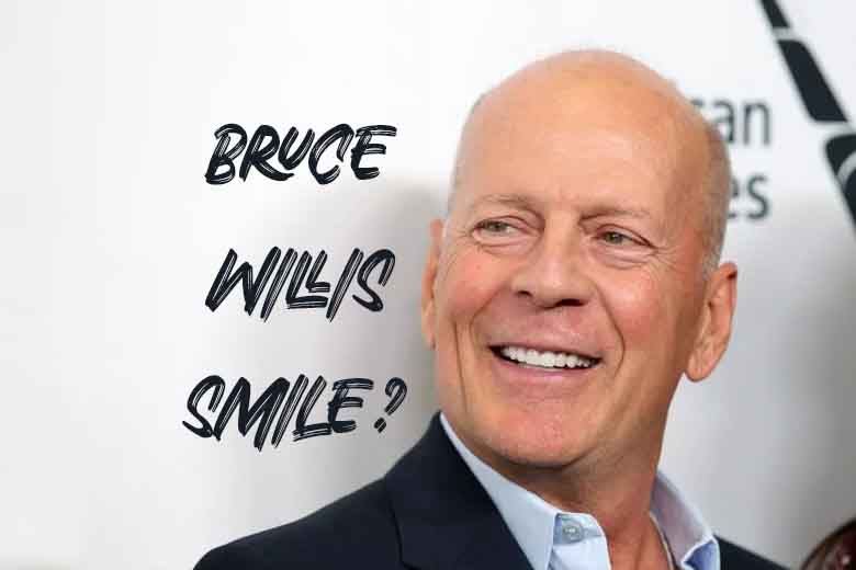 Bruce Willis Smile? Discover Male Smile Trends in Antalya (Yakında Türkçe)