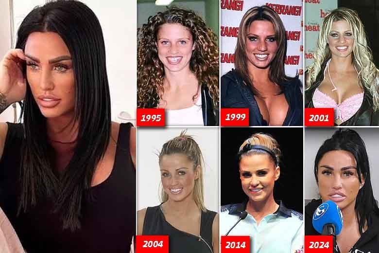 Katie Price’s Dental Journey: (Yakında Türkçe)
