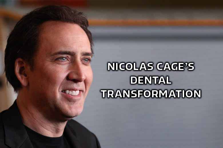 Nicolas Cage’s Secret Smile Makeover (Yakında Türkçe)