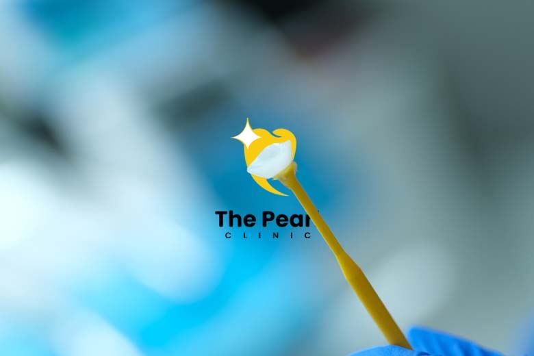 Laminate Veneers: All You Need to Know! (Yakında Türkçe)